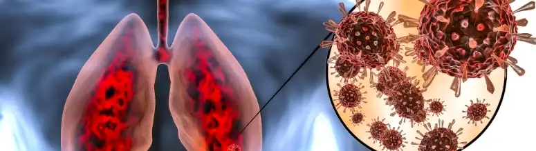 Extracto de Scutellaria Baicalensis Extracto de Scutellaria Baicalensis