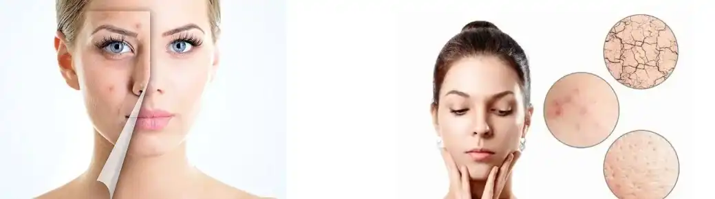 Extracto de Centella Asiatica en polvo Extracto de Centella Asiatica en polvo