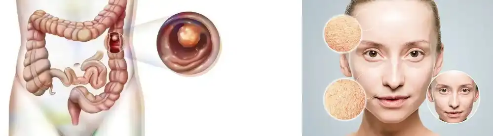 YUCCA EXTRACT YUCCA EXTRACT