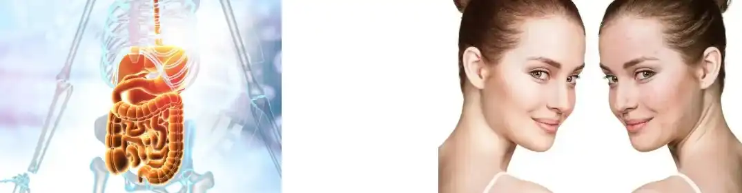 Extracto de Phellinus Igniarius Extracto de Phellinus Igniarius