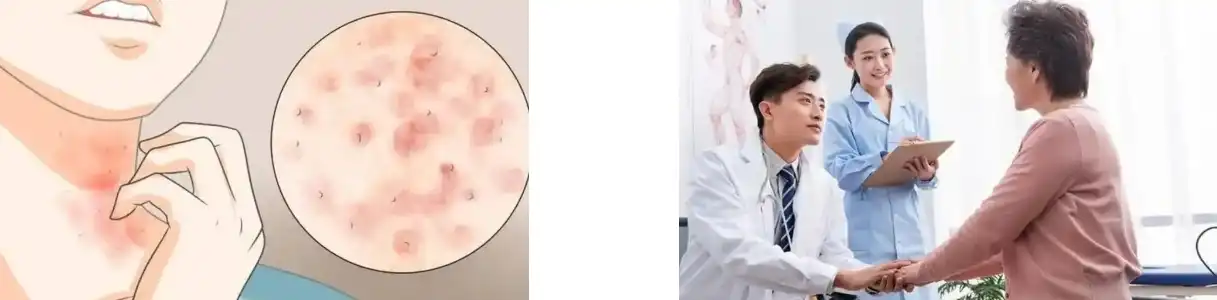 PINE POLLEN POWDER PINE POLLEN POWDER