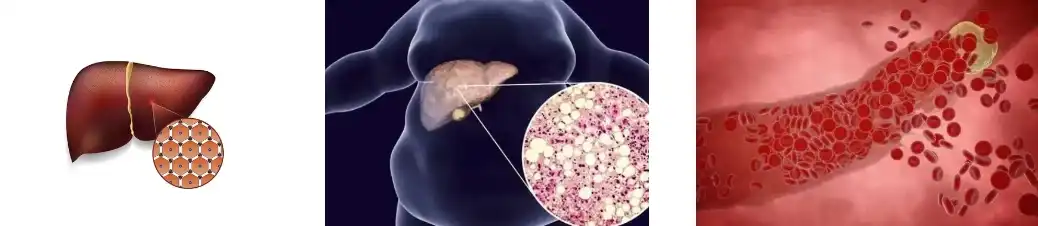 EXTRACTO DE ALCACHOFA EXTRACTO DE ALCACHOFA