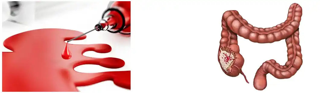 Astragalus Extract Powder Astragalus Extract Powder