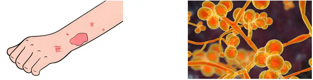 Rosemary Leaf Extract Rosemary Leaf Extract