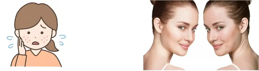 Rosemary Leaf Extract