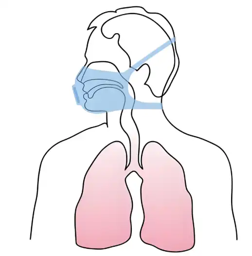 Boswellia Serrata Extract Powder Boswellia Serrata Extract Powder