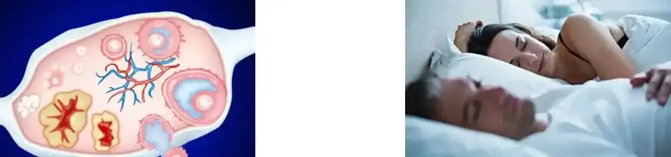 Icariin Powder Extract Icariin Powder Extract