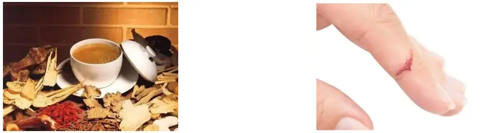 Rhubarb Root Extract Powder Rhubarb Root Extract Powder