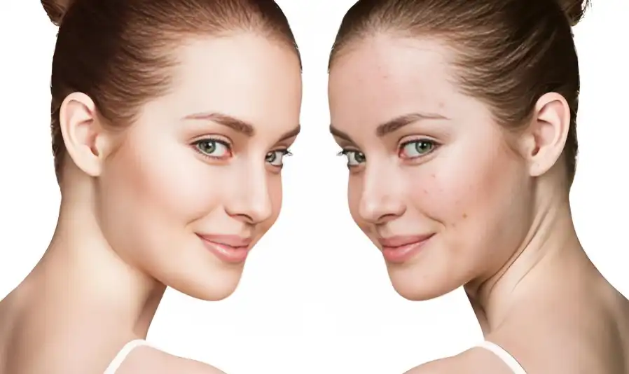 Astaxanthin Powder Astaxanthin Powder