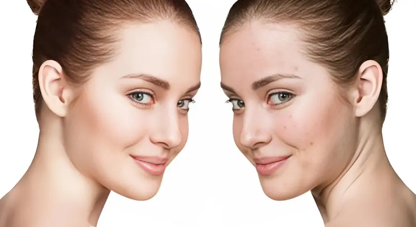 Sparassis Crispa Extract